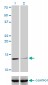B2M Antibody (monoclonal) (M01)